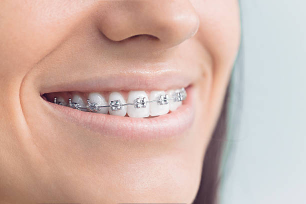Laser Dentistry in Plymouth, IN